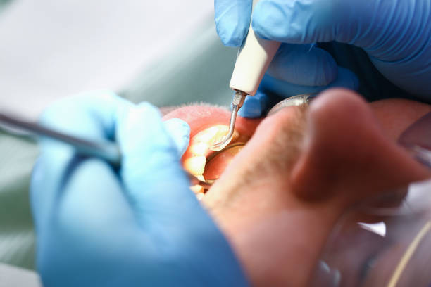 Best Emergency Dental Care for Trauma or Injury in South Miami, FL