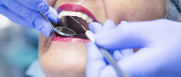 Best Weekend Emergency Dentist in South Miami, FL