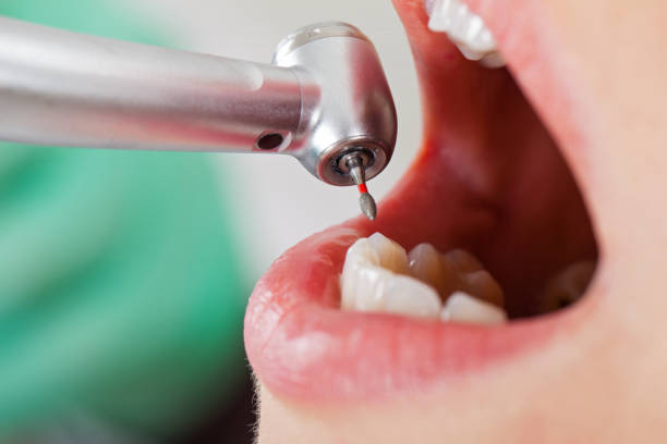 Best Pediatric Emergency Dentist in South Miami, FL